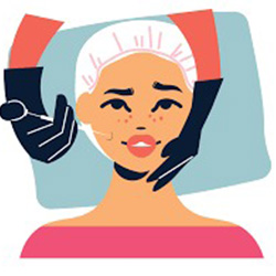 Dimple creation surgery